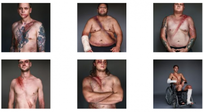 Galerie FOTO: Centura le-a salvat viața, dar le-a lăsat și o amprentă! Tu ce alegi? - Photo